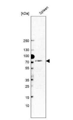 Western Blot: MxA/Mx1 Antibody [NBP2-56175]