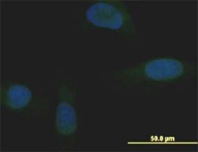 Immunocytochemistry/ Immunofluorescence: Mxi1 Antibody (1B10) [H00004601-M11]