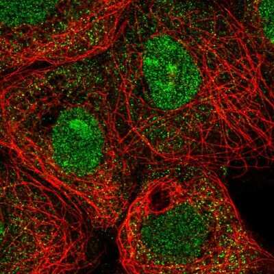 Immunocytochemistry/ Immunofluorescence: Mxi1 Antibody [NBP2-58356]