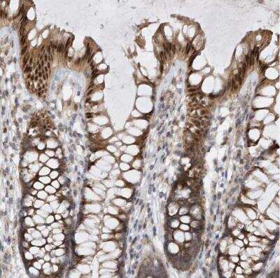 Immunohistochemistry-Paraffin: Mxi1 Antibody [NBP1-88626]