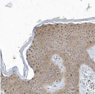 Immunohistochemistry-Paraffin: Mxi1 Antibody [NBP1-88626]