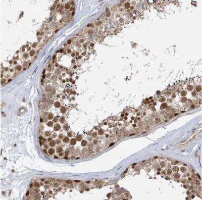 Immunohistochemistry-Paraffin: Mxi1 Antibody [NBP1-88626]