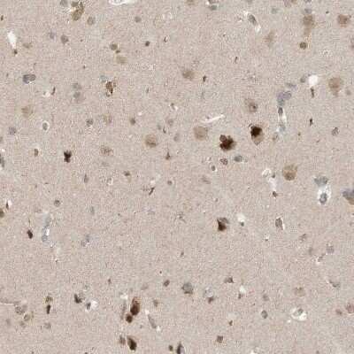 Immunohistochemistry-Paraffin: Mxi1 Antibody [NBP1-88626]