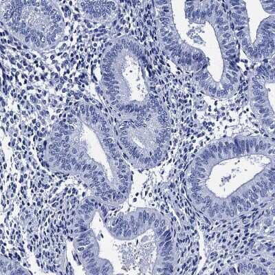 Immunohistochemistry-Paraffin: MyBPC3 Antibody [NBP2-13631]