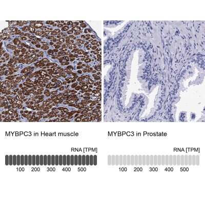 Immunohistochemistry-Paraffin: MyBPC3 Antibody [NBP2-13631]