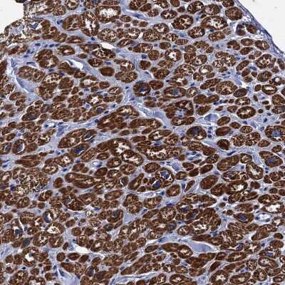 Immunohistochemistry-Paraffin: MyBPC3 Antibody [NBP2-13631]