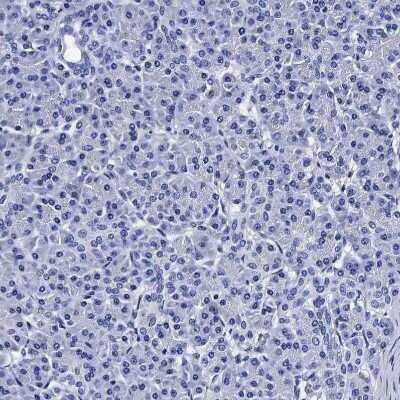 Immunohistochemistry-Paraffin: MyBPC3 Antibody [NBP2-13631]