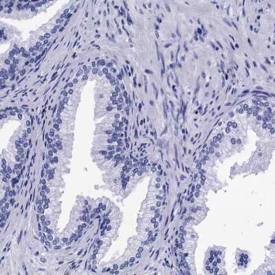 Immunohistochemistry-Paraffin: MyBPC3 Antibody [NBP2-13631]
