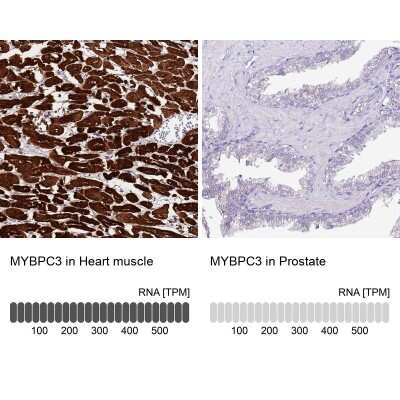 Immunohistochemistry-Paraffin: MyBPC3 Antibody [NBP2-13632]