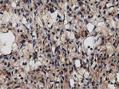 Immunohistochemistry-Paraffin: MyD88 Antibody (OTI2B2) [NBP2-03369]
