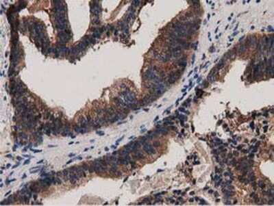 Immunohistochemistry-Paraffin: MyD88 Antibody (OTI2B2) [NBP2-03369]