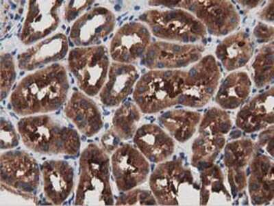 Immunohistochemistry-Paraffin: MyD88 Antibody (OTI2B2) [NBP2-03369]