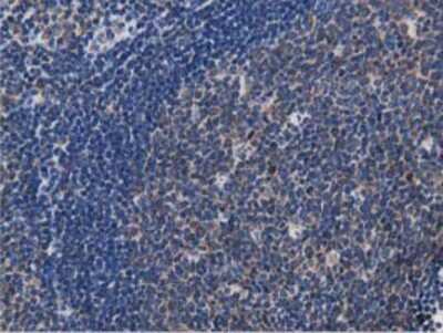 Immunohistochemistry-Paraffin: MyD88 Antibody (OTI2B2) [NBP2-03369]