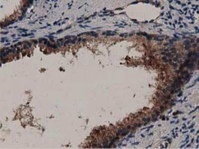 Immunohistochemistry-Paraffin: MyD88 Antibody (OTI2B2) [NBP2-03369]