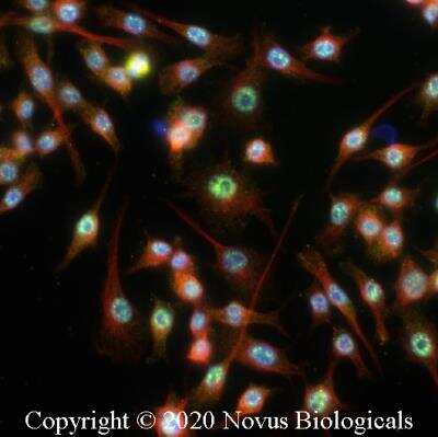 Immunocytochemistry/ Immunofluorescence: MyD88 Antibody - BSA Free [NB100-56698]
