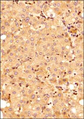 Immunohistochemistry-Paraffin: MyD88 Antibody - BSA Free [NB100-56698]