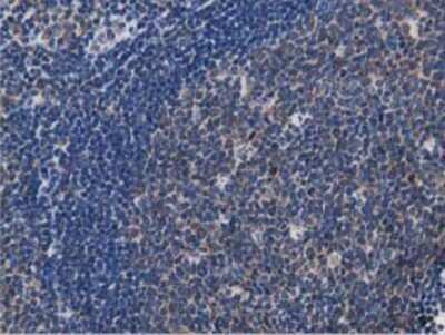 Immunohistochemistry: MyD88 Antibody (OTI2B2) - Azide and BSA Free [NBP2-72842]