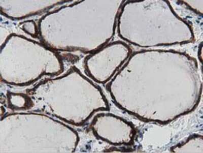 Immunohistochemistry: MyD88 Antibody (OTI2B2) - Azide and BSA Free [NBP2-72842]