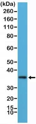 Western Blot: MyD88 Antibody (RM306) [NBP2-61565]