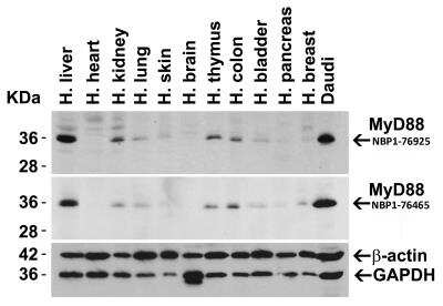 Western Blot: MyD88 AntibodyBSA Free [NBP1-76465]