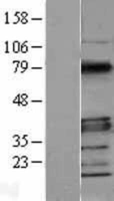 Western Blot: MyD88 Overexpression Lysate [NBL1-13419]