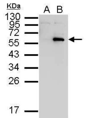 Western Blot: Myc Epitope Tag Antibody [NBP2-43691]