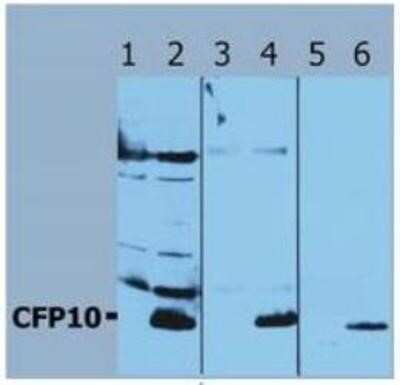 Western Blot: Mycobacterium Tuberculosis CFP10 AntibodyBSA Free [NB110-58737]