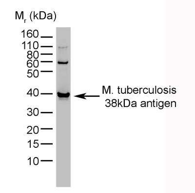Western Blot: Mycobacterium tuberculosis Antibody (BGN/1209/3875)BSA Free [NB100-62769]