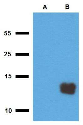 Western Blot: Mycobacterium tuberculosis antigen Tb10.3 Antibody [NBP2-62181]