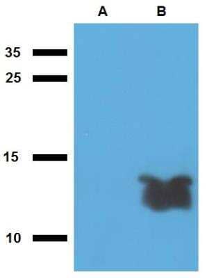 Western Blot: Mycobacterium tuberculosis antigen Tb7.7 Antibody [NBP2-62183]