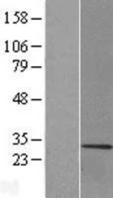 Western Blot: MBP Overexpression Lysate [NBL1-12934]