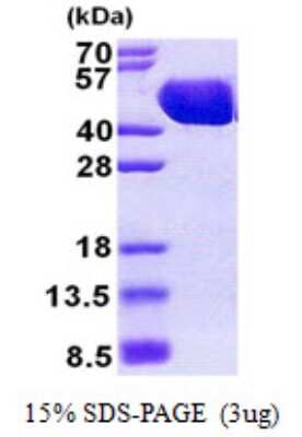 SDS-PAGE: Recombinant E. coli MBP His Protein [NBP2-22654]