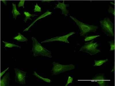 Immunocytochemistry/ Immunofluorescence: Myelin PLP Antibody (2D7) [H00005354-M03]