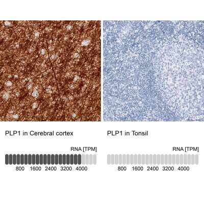 Immunohistochemistry-Paraffin: Myelin PLP Antibody (CL10622) [NBP3-07989]