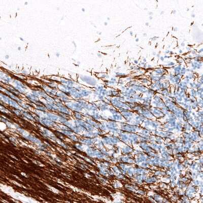 Immunohistochemistry-Paraffin: Myelin PLP Antibody (CL10622) [NBP3-07989]