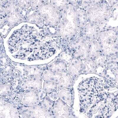 Immunohistochemistry-Paraffin: Myelin PLP Antibody (CL10622) [NBP3-07989]