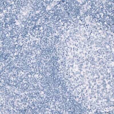 Immunohistochemistry-Paraffin: Myelin PLP Antibody (CL10622) [NBP3-07989]