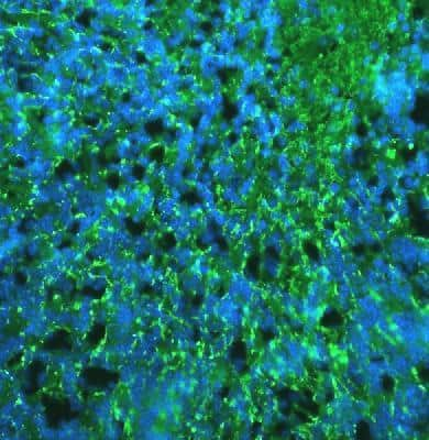 Immunocytochemistry/ Immunofluorescence: Myelin PLP Antibody [NB100-1608]