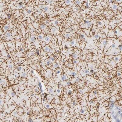 Immunohistochemistry-Paraffin: Myelin PLP Antibody [NBP1-87781]