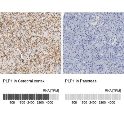 Immunohistochemistry-Paraffin: Myelin PLP Antibody [NBP1-87781]