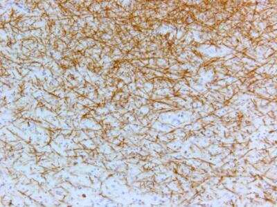 Immunohistochemistry-Paraffin: Myelin PLP Antibody [NBP1-87781]