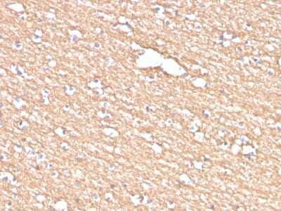 Immunohistochemistry-Paraffin: Myelin PLP Antibody (PLP1/4259) - Azide and BSA Free [NBP3-08534]