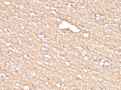 Immunohistochemistry-Paraffin: Myelin PLP Antibody (PLP1/4259) [NBP3-07603]