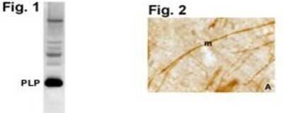 Western Blot: Myelin PLP Antibody [NB100-74503]