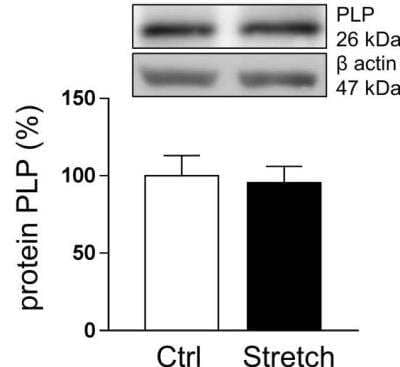 Western Blot: Myelin PLP Antibody [NB100-74503]