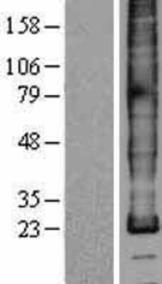 Western Blot: Myelin PLP Overexpression Lysate [NBL1-14523]