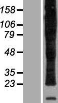 Western Blot: Myelin PLP Overexpression Lysate [NBP2-04617]