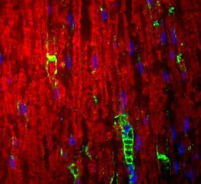 Immunocytochemistry/ Immunofluorescence: Myelin Protein Zero Antibody [NB100-1607]