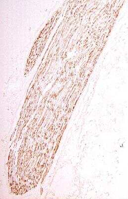 Immunohistochemistry: Myelin Protein Zero Antibody [NB100-1607]
