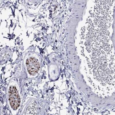 Immunohistochemistry-Paraffin: Myelin Protein Zero Antibody [NBP2-68878]